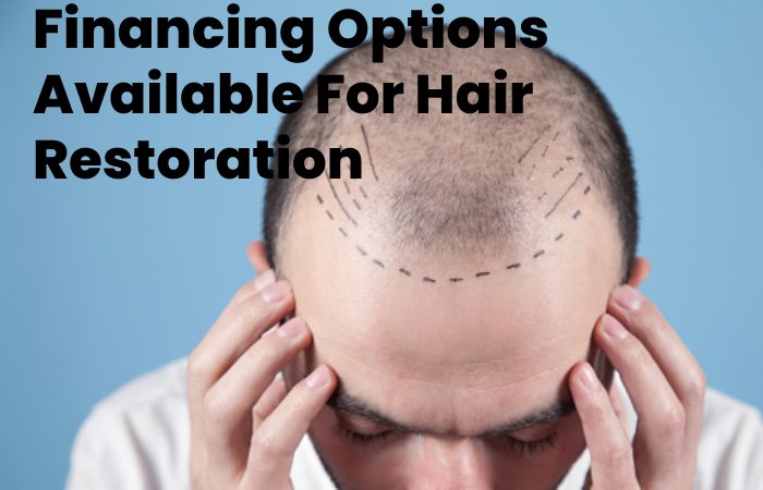 Financing Options Available For Hair Restoration