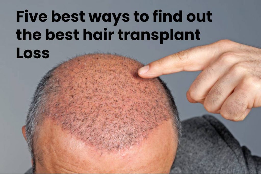 Five best ways to find out the best hair transplant Loss