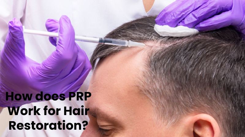 How does PRP Work for Hair Restoration?