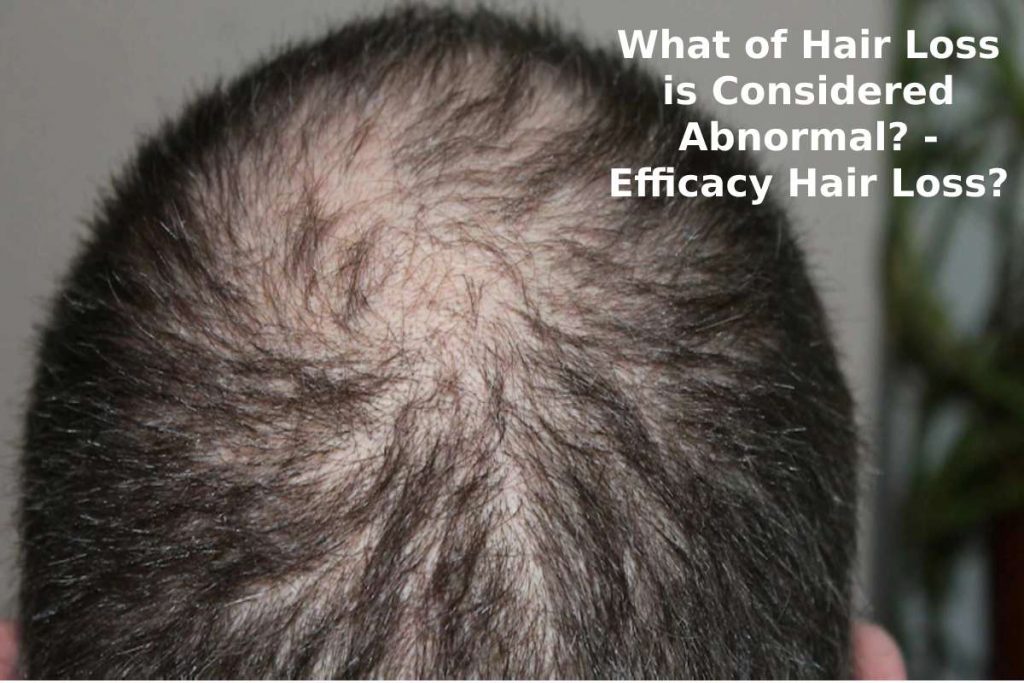 What of Hair Loss is Considered Abnormal? - Efficacy Hair Loss?