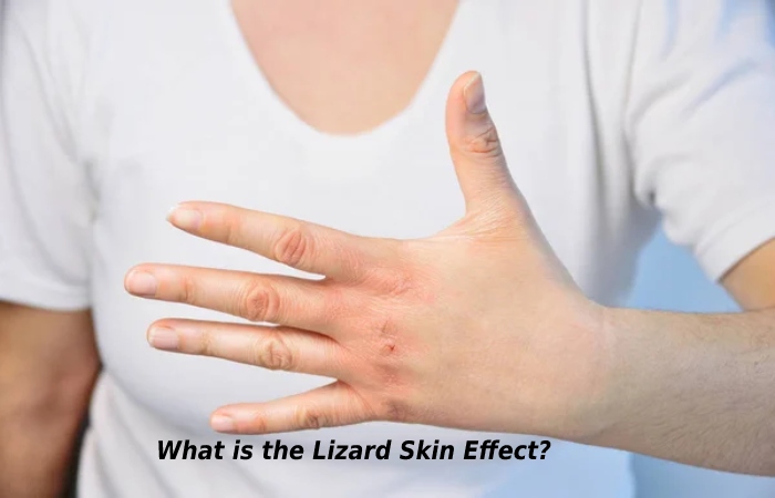 What is the Lizard Skin Effect_