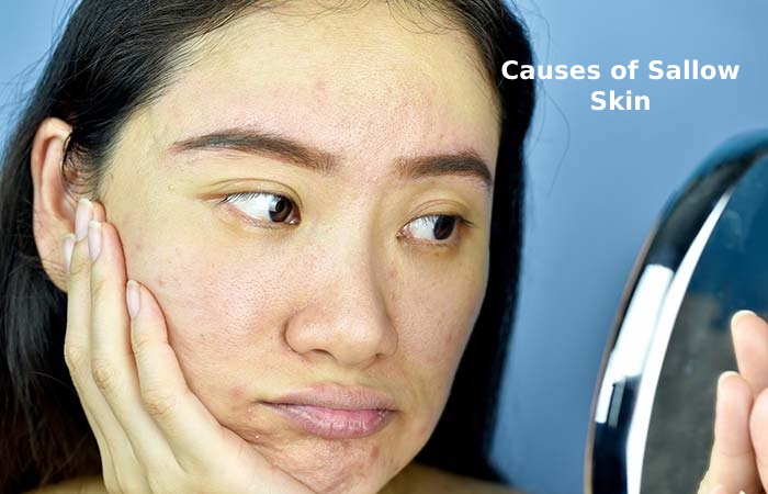 Causes of Sallow Skin