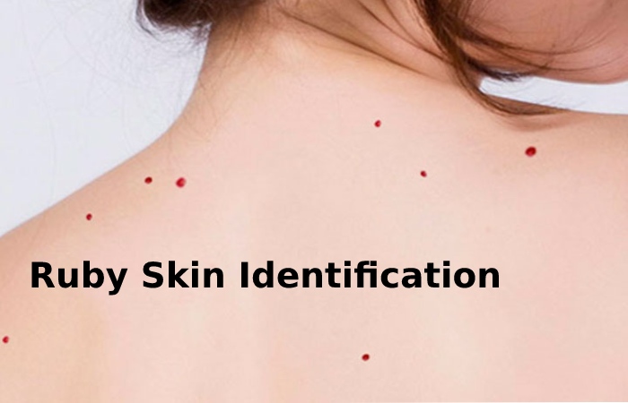 Ruby Skin Identification (1)