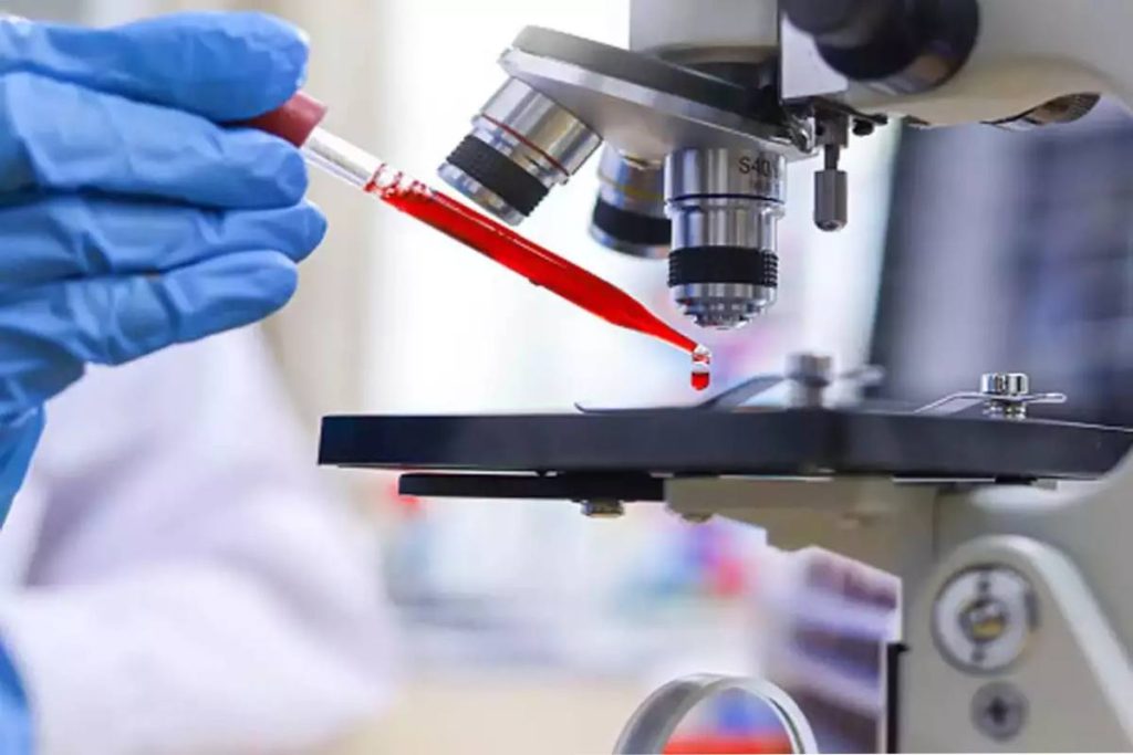 Rajkotupdates.news_emm-negative-rare-blood-group-found-in-rajkot-man-11th-such-case-worldwide